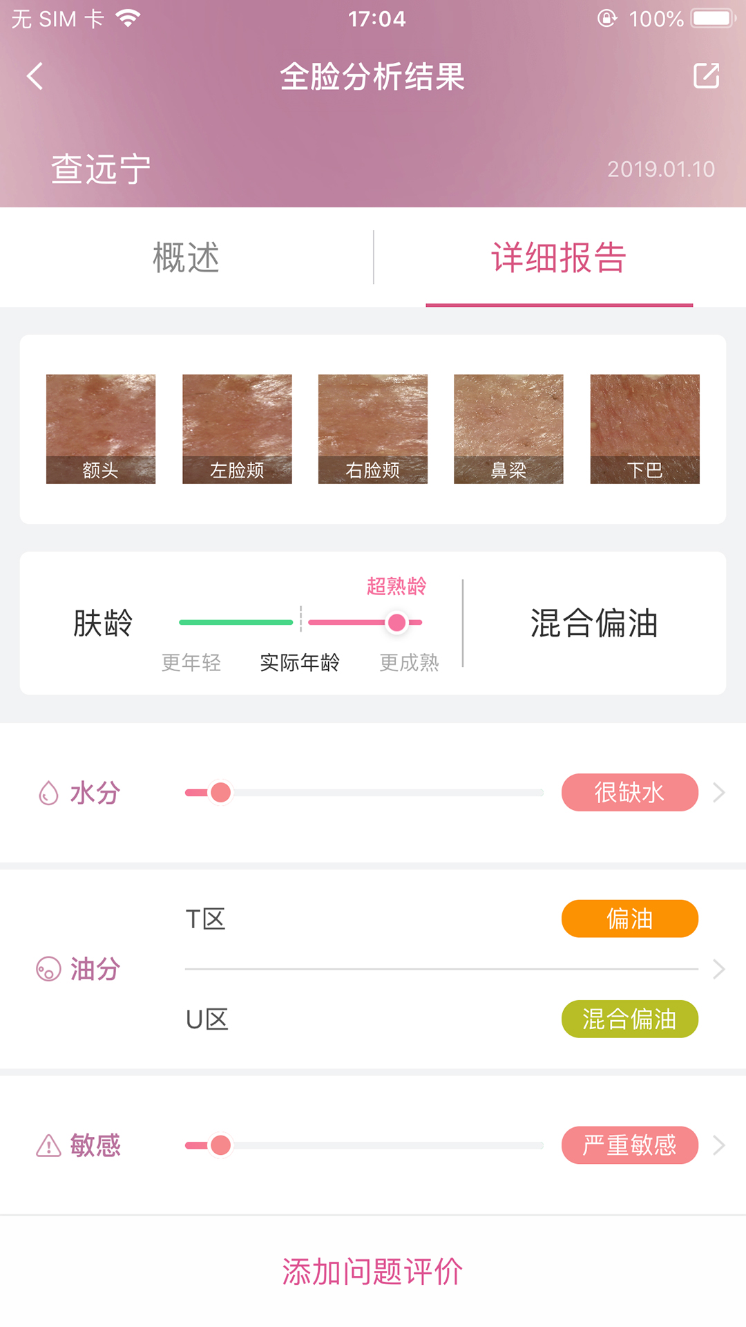 @(currentSoft.name)图@(i + 1)