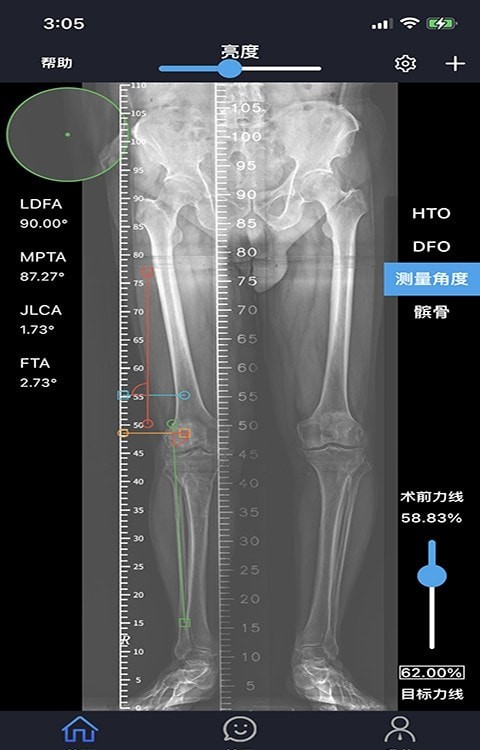 华保膝望官方版